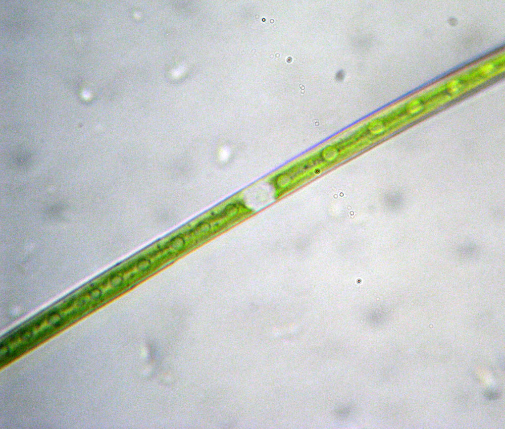 Closterium gracile?